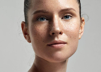 臉上有斑怎么去掉呢