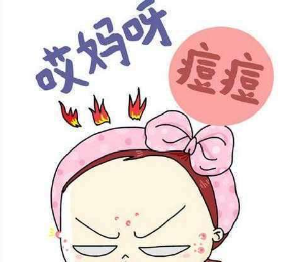 常見的祛痘小妙招