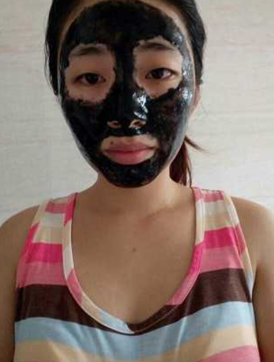 哪種去痘印護(hù)膚品比較好