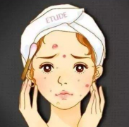 痘印的種類有很多且顏色不同