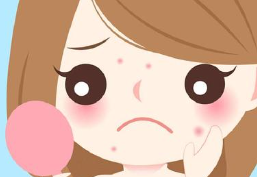 臉上為什么會長痘痘