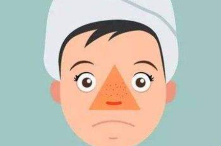 白醋能去黑頭粉刺嗎