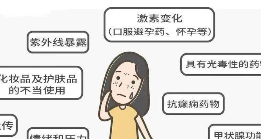 祛斑霜真能祛斑嗎