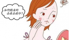 怎樣可以祛痘去痘印