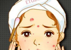 祛痘加盟如何提高利潤