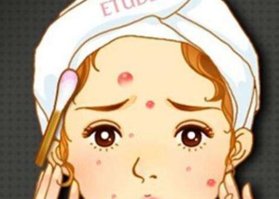 祛痘加盟如何提高利潤(rùn)