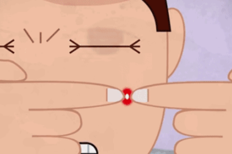 熙凝顏祛痘加盟簡介痘痘肌要避免的幾大要素