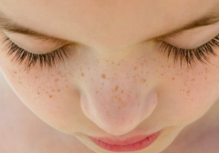 想要皮膚變年輕就找熙凝顏加盟