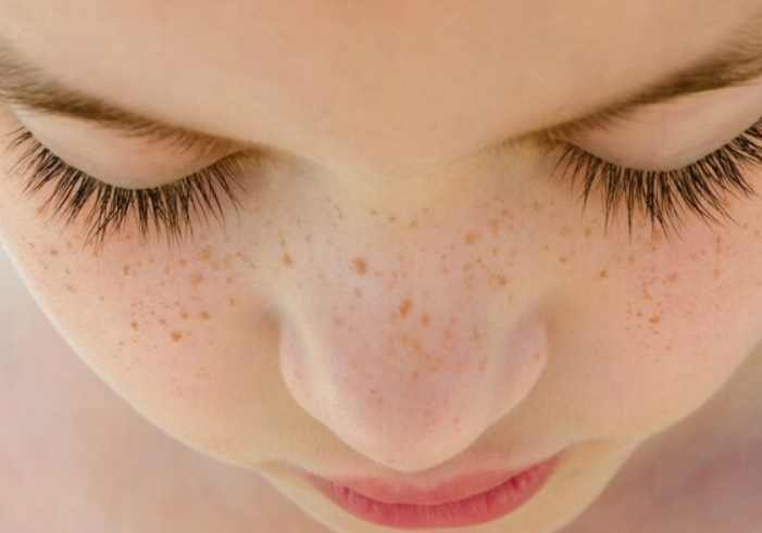 想要皮膚變年輕就找熙凝顏加盟