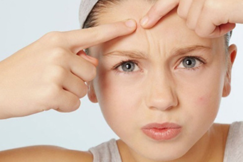 額頭上長痘痘這么辦？熙凝顏告訴你