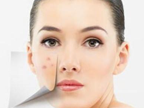 今天熙凝顏來(lái)給大家聊聊祛痘印小常識(shí)