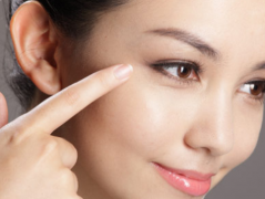 日曬斑是什么樣子那？