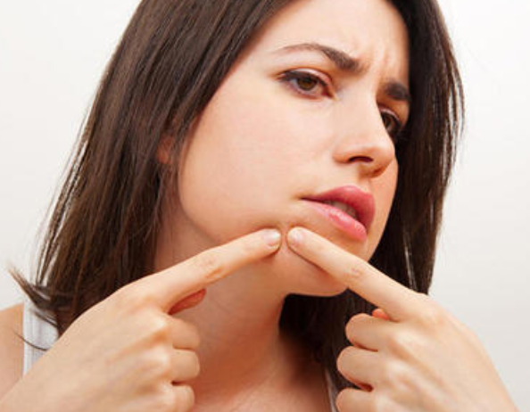 食療祛痘小方法熙凝顏來教你