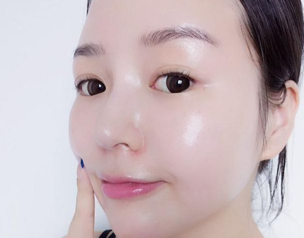 臉上的斑該如何去除那？熙凝顏祛斑加盟告訴你