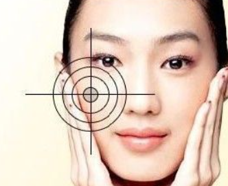 臉上有斑該怎樣才能祛斑那？