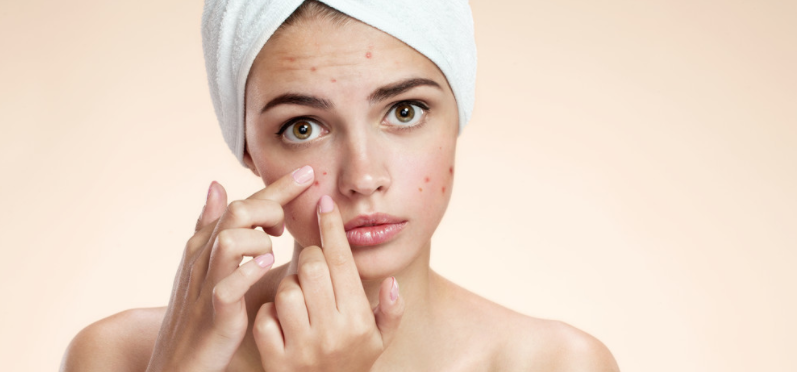 熙凝顏祛斑加盟網(wǎng)教你四招祛斑的小方法