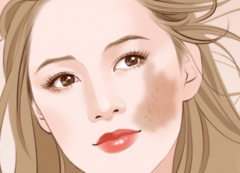 激光祛斑有副作用嗎？