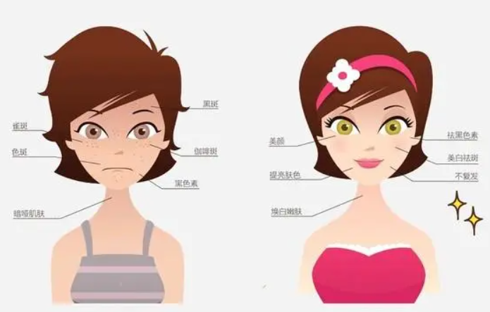 祛斑神器了解多少那