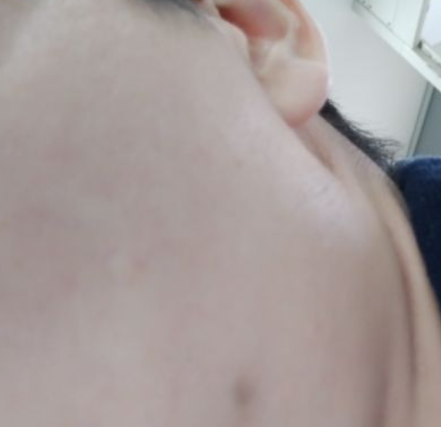 如何祛斑和談斑