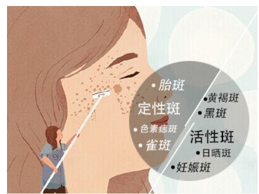 熙凝顏帶你了解斑的形成