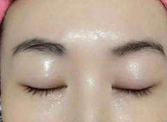 熙凝顏帶你了解民間祛斑的小方法