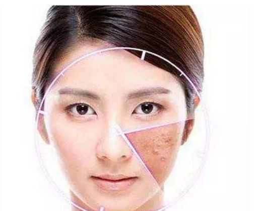 熙凝顏帶你了解中醫(yī)祛斑