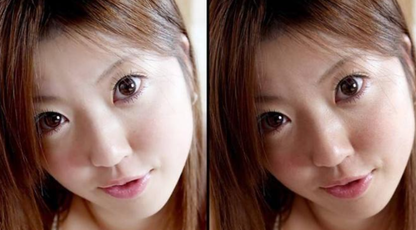 熙凝顏帶你如何如何完全去除祛斑