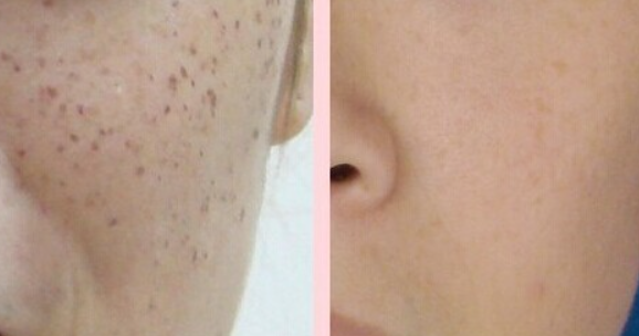 熙凝顏帶你夏日美白集合