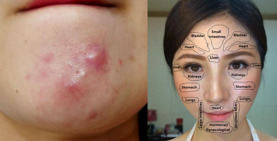 熙凝顏祛斑加盟網(wǎng)帶你了解祛斑的對策