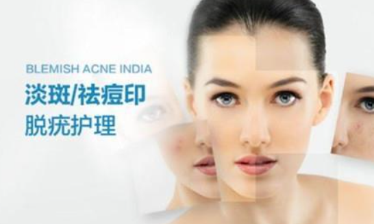 熙凝顏祛斑加盟網(wǎng)告訴你四個祛斑技能