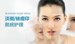 熙凝顏祛斑加盟帶您了解黃褐斑