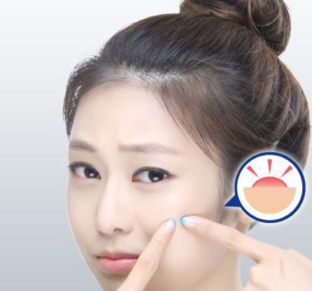 熙凝顏祛斑加盟