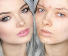 如何擺脫老年斑?熙凝顏祛斑加盟網(wǎng)告訴你