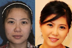 臉上出現(xiàn)上面狀況就該排毒了那？熙凝顏告訴你