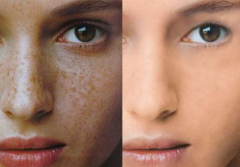 蘆薈如何祛斑？熙凝顏祛斑加盟網(wǎng)告訴你