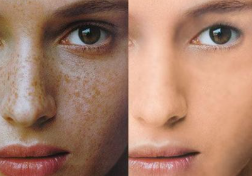 蘆薈如何祛斑？熙凝顏祛斑加盟網(wǎng)告訴你