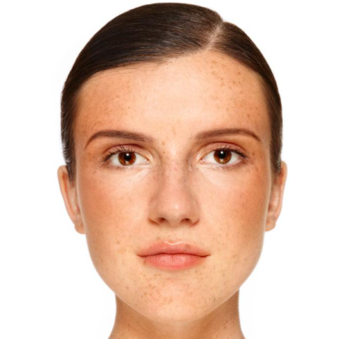 如何祛斑那？熙凝顏祛斑加盟網(wǎng)給你介紹一下