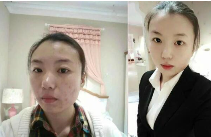 色斑增多的女生都應(yīng)該知道的八件事