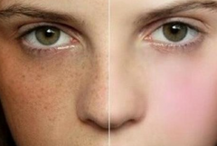 花三分鐘給你看最好的祛斑方法