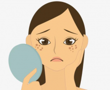 祛斑之前注意事項