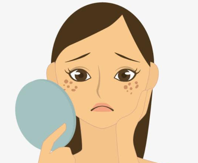 祛斑之前注意事項(xiàng)