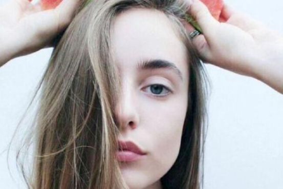 怎樣祛除黃褐斑和蝴蝶斑