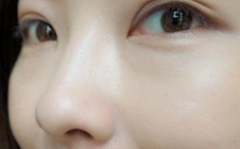 一周美白肌膚祛斑