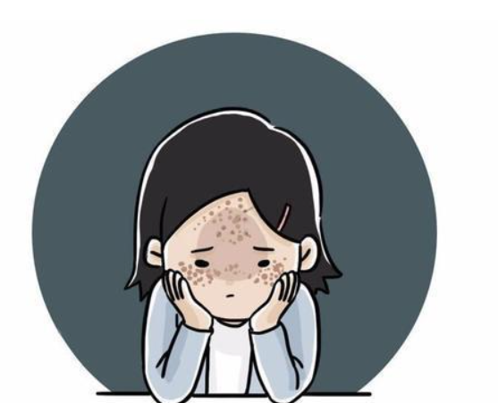 黃褐斑的淡化方法